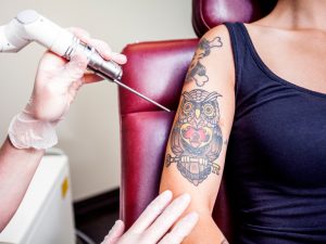 Fix your Tattoo through some medical treatment