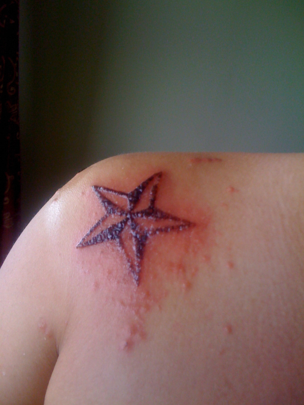 Tattoo Rashes or red bumps image