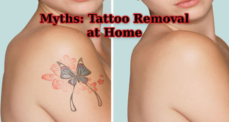 Myth: Tattoo Removal at Home-Remedies | How To Remove Tattoos