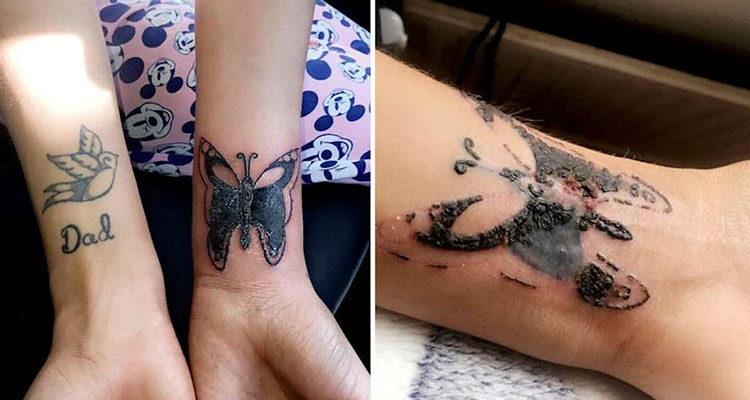 Tips for Tattoo Infection Identification and Treatment
