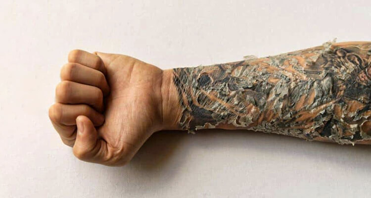 tattoo cracking on arm
