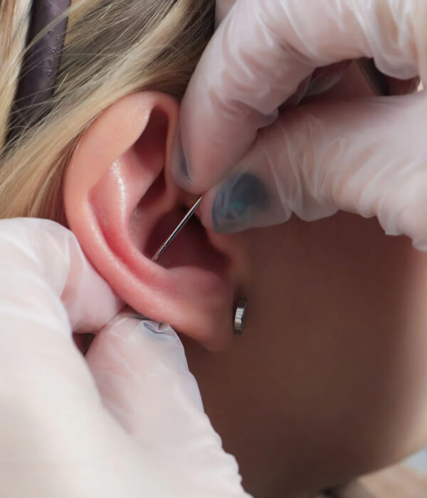The procedure of conch piercing