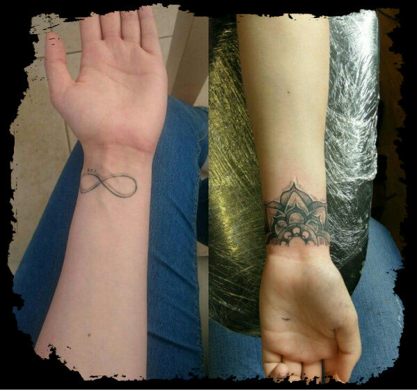 Mandala Cover-up Tattoos
