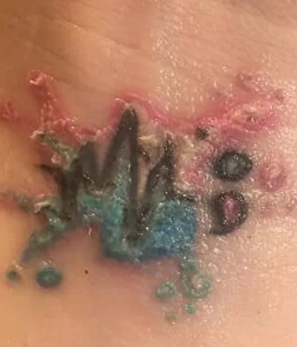 What is a Tattoo Infection Causes and Risks - Trending Tattoo What-is-a-Tattoo-Infection_ Causes-and-Risks