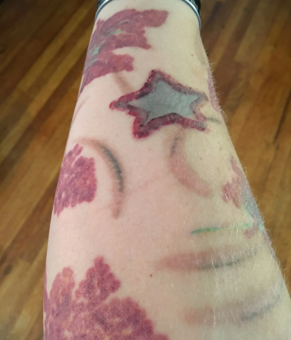 Safety and Side Effects