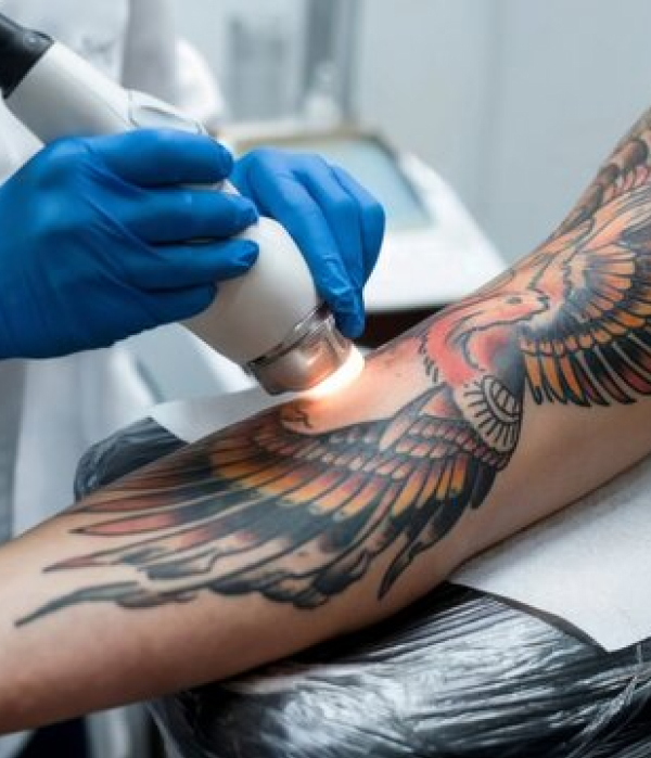 Setting Realistic Expectations